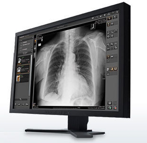 Carestream Image Suite V4