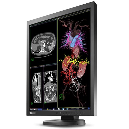 Eizo Radiforce MX215