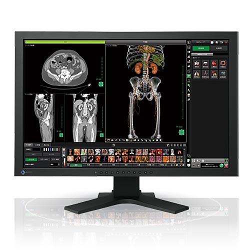 Eizo Radiforce MX241W