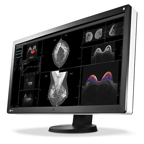 Eizo Radiforce RX850 [""]