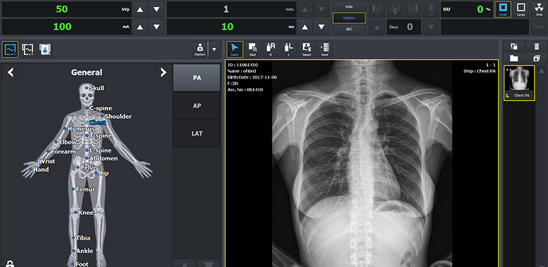 Vieworks / Medlink VXvue Aquisition Software