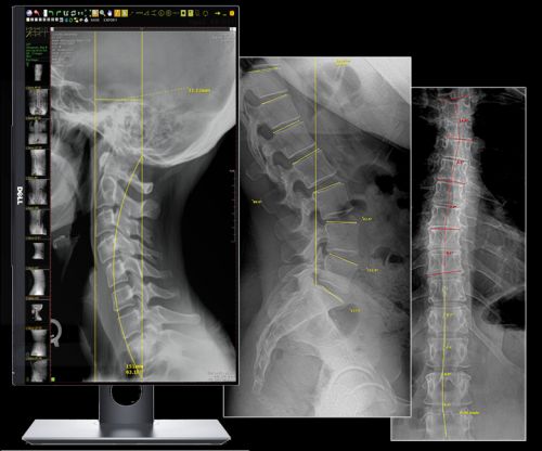 20/20 Imaging Opal-CHIRO