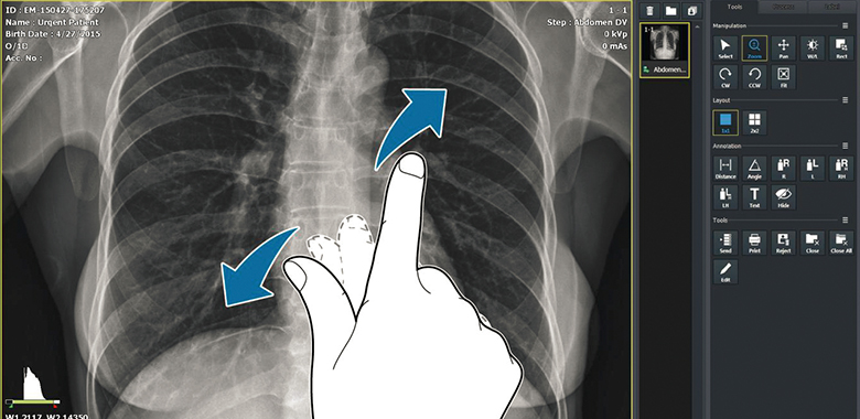 Vieworks / Medlink VXvue Aquisition Software