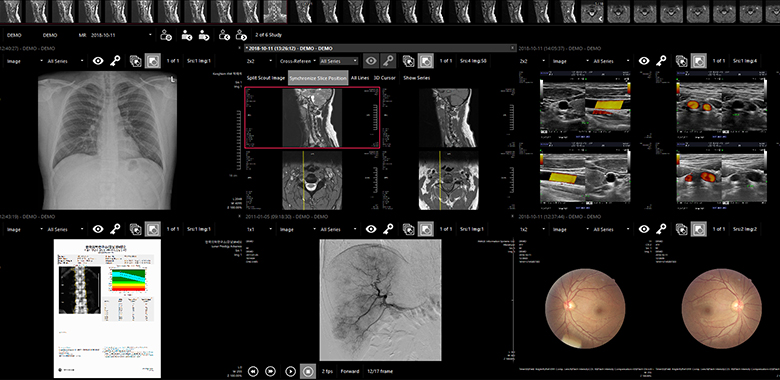 Vieworks / Medlink QXLink 3.3