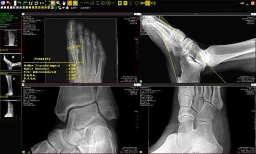 20/20 Imaging Opal-RAD